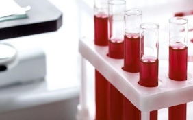血制品投研框架：一个存量玩家博弈的增量市场